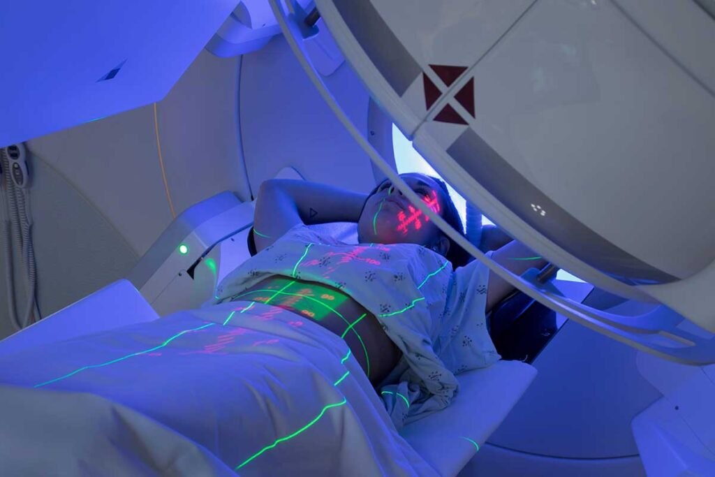 radiation therapy